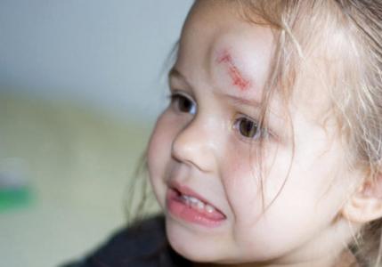 Что делать, если ребенок ударил затылок: на что обратить внимание и какие бывают последствия ушиба головы?
